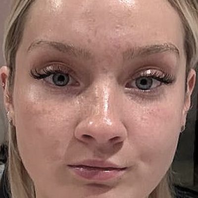 Maelys RENARD PETITE DE FRANCE 2026